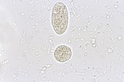 12-ab-trof-saf-1-con-2-nuclei.jpg