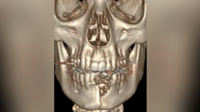 jaw.jpg