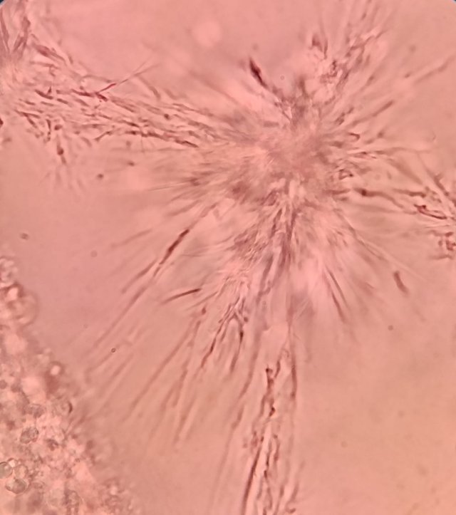 branchyomyces en cerebro.jpeg