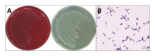 snakeskin-gourami-Streptococcus-agalactiae-blood-agar.jpg