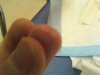 bite marks shown.jpg bite marks shown.jpg