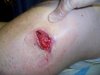 wound2.jpg