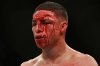 bj penn aftermath.jpg