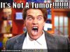 tumor.jpg
