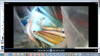 SDF HB  arowana top View.png