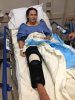 Cat-Zingano-Knee-Surgery.jpg