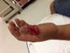 thumb1.jpeg