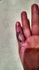 finger.jpg finger.jpg
