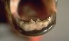 pacu-teeth.jpg