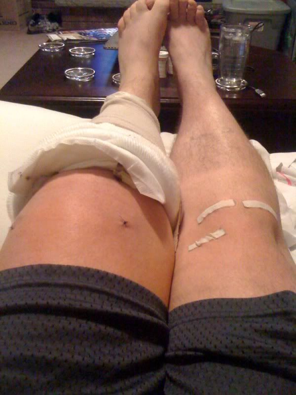 legs.jpg