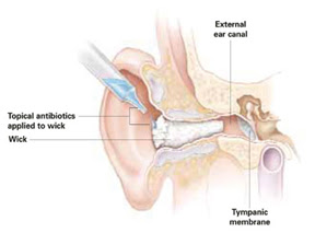 Ear+Wick.jpg