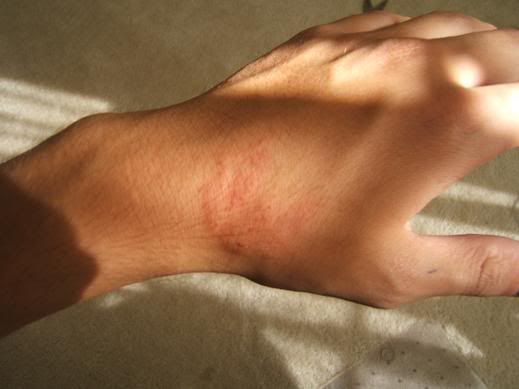 bite001.jpg