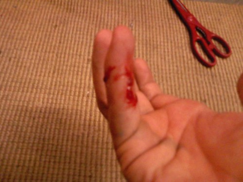 So, my pacu bit me. Semi-gruesome pics inside